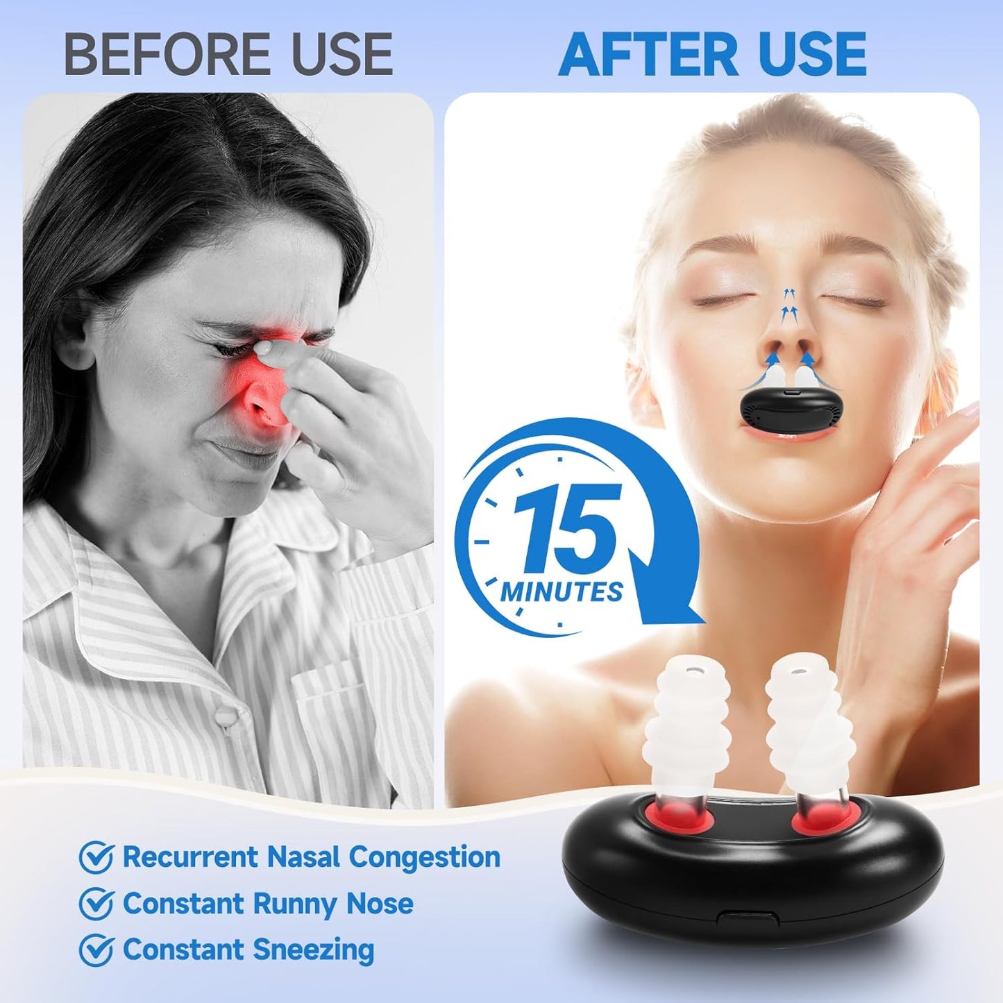 Infrared devices for treating allergic and chronic rhinitis.