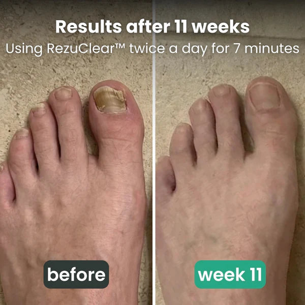 CraftClear™  3-in-1 therapy device