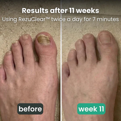 CraftClear™  3-in-1 therapy device